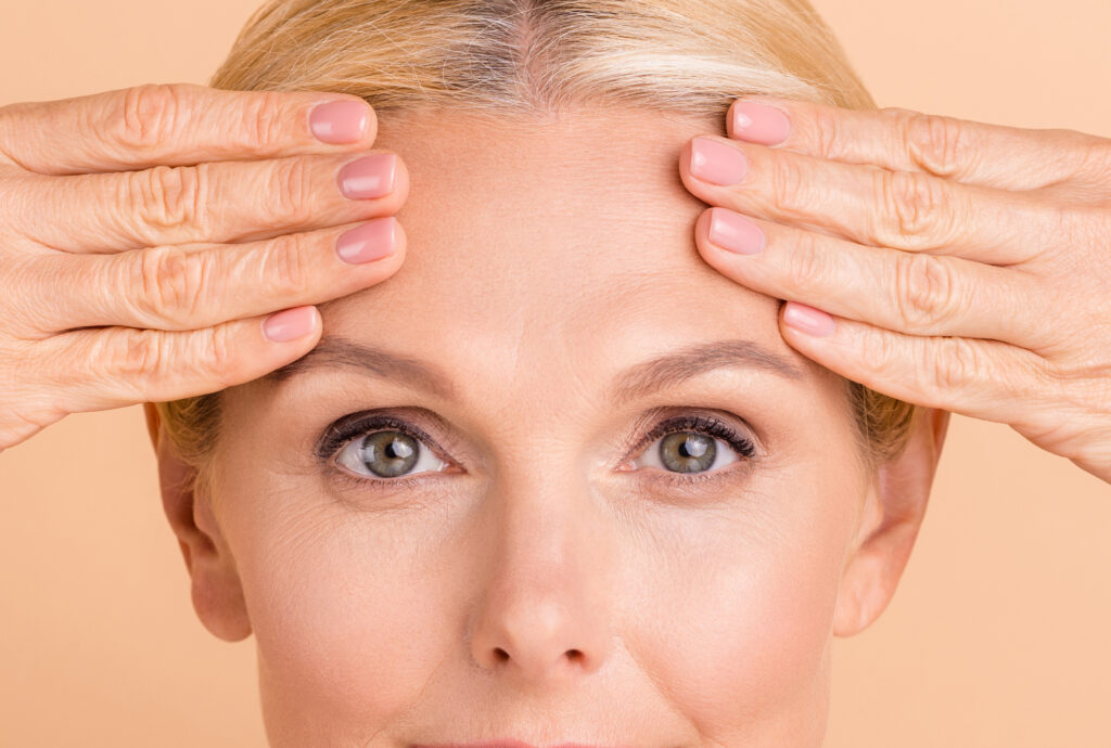 browlift2