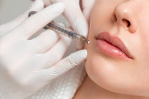 Lip filler photo
