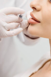 Lip Filler