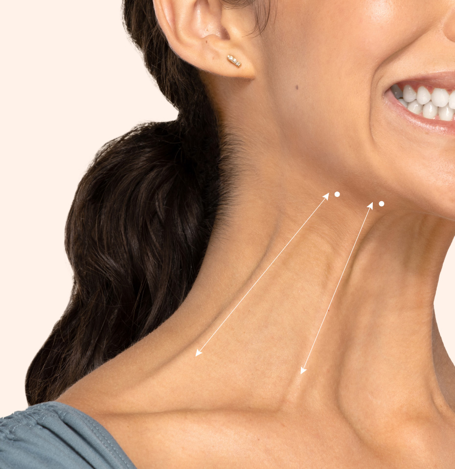 Neck Bands Botox